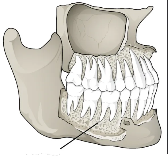 term image