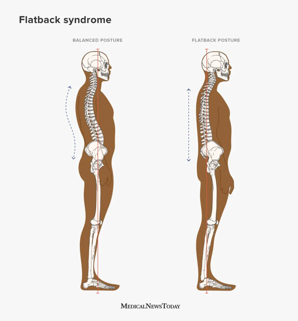 definition image