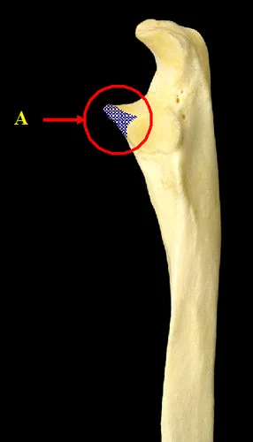 definition image