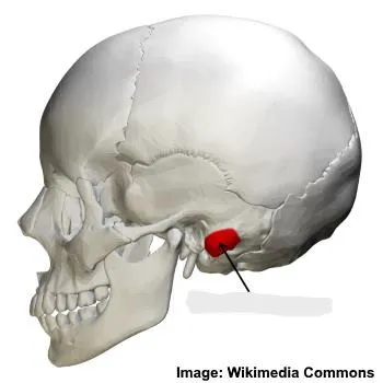 term image