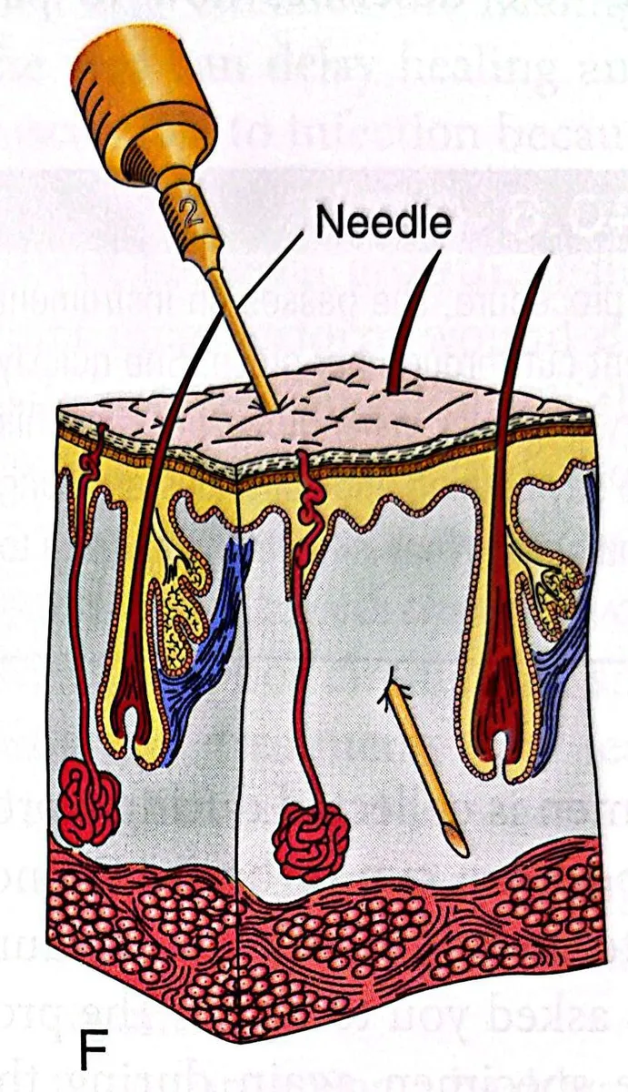 definition image