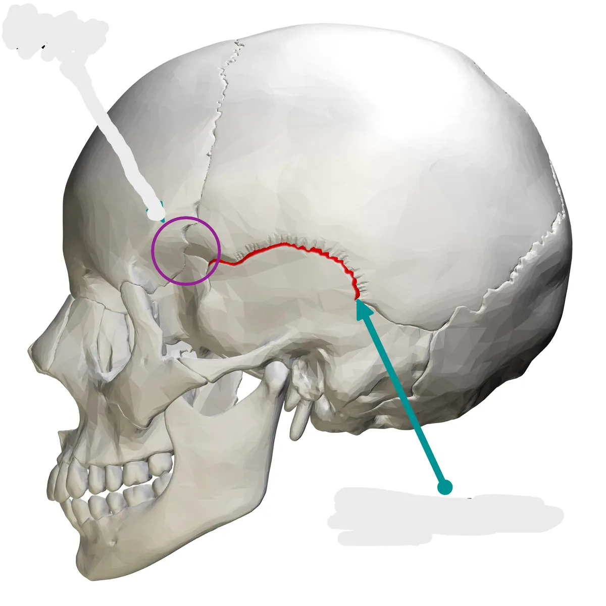 term image