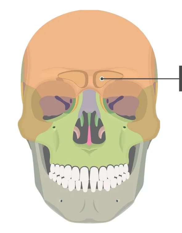 term image